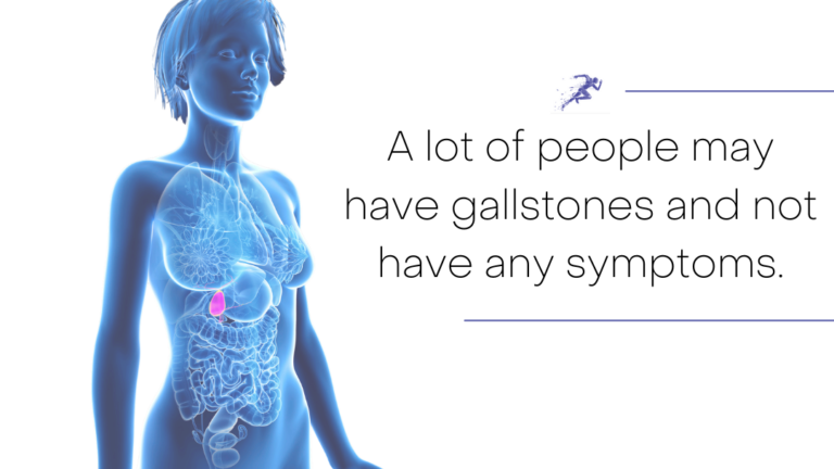 gallstones diagram